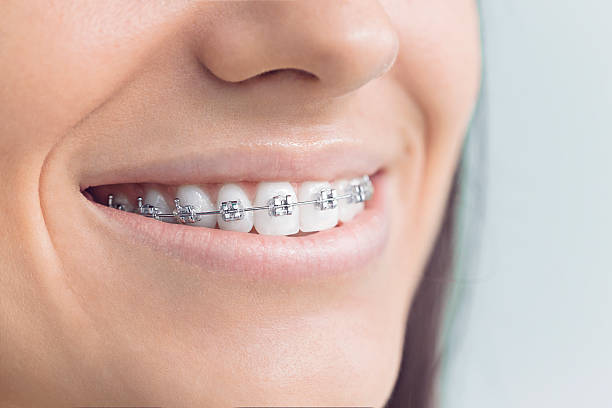 Best Veneers and Lumineers  in Winnetka, IL